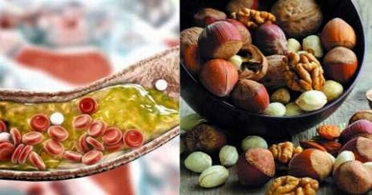 हाई कोलेस्ट्रॉल को खत्म कर देंगे ये ड्राई फ्रूट्स, आप भी जान लीजिए उनके नाम